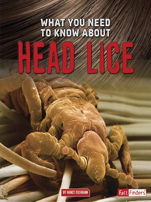 cover image of What You Need to Know about Head Lice